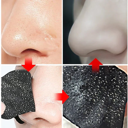 10pcs Blackhead & Acne Removal Nose Strips – Instant Pore Unclogging and Deep Cleansing Patches for Clearer Skin