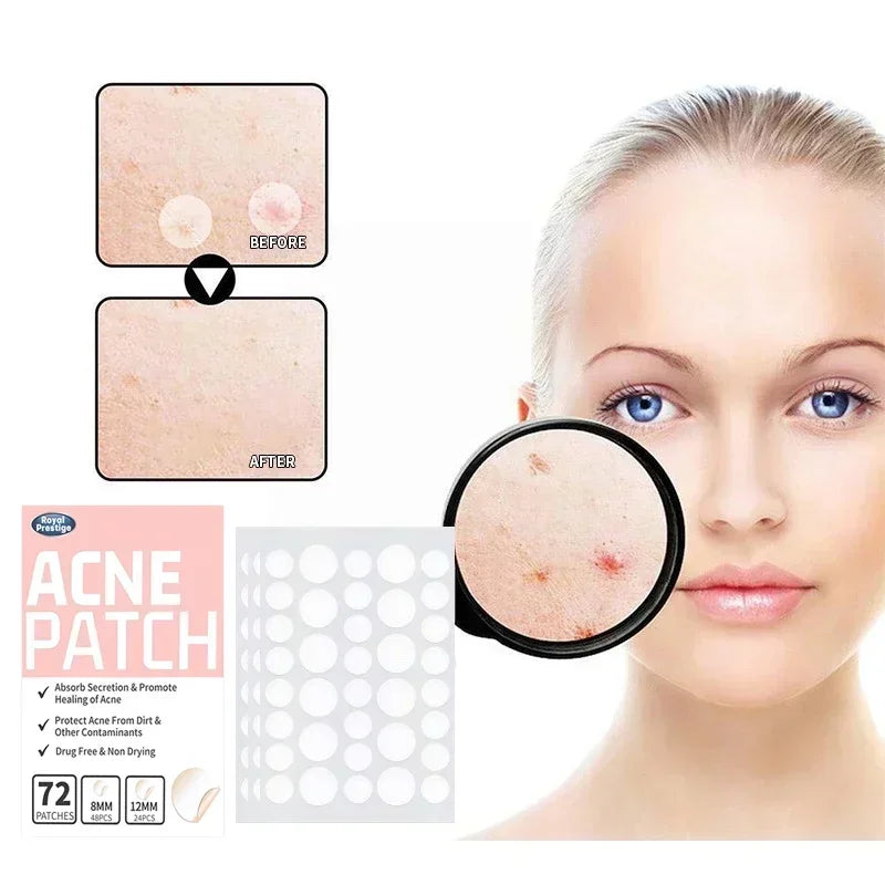 72 pcs Invisible Hydrocolloid Acne Patches – Waterproof Pimple Removal Stickers for Anti-Acne Spot Treatment and Skin Repair